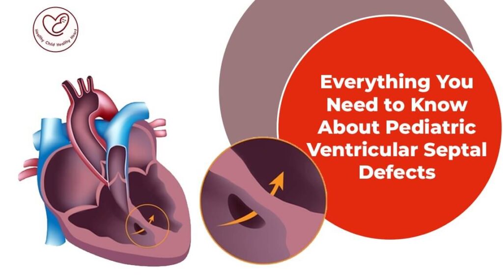 Everything You Need to Know About Pediatric Ventricular Septal Defects
